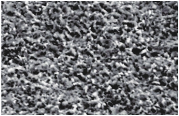 SEM micrograph of browned copper foil surface